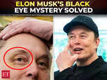 Image for Elon Musk blames son 'X' for black eye